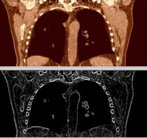 تولید تصاویر سی تی اسکن چهار بعدی مبتنی بر واقعیت