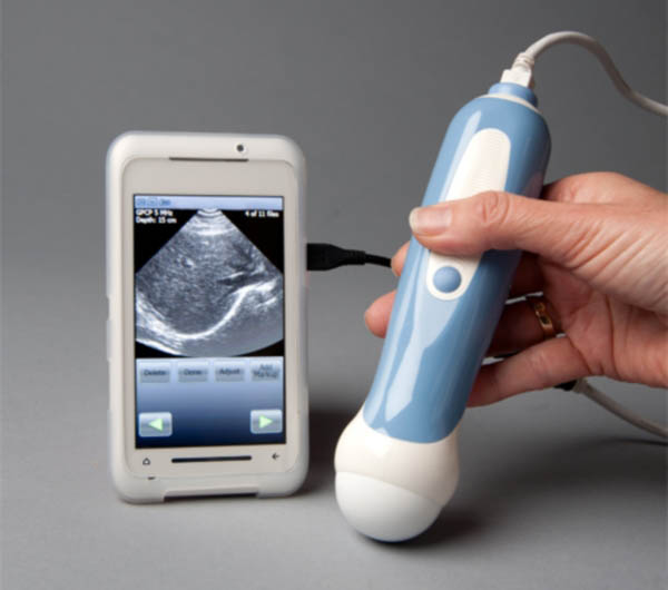 ساخت دستگاه سونوگرافی